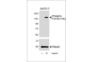 Western blot analysis of lysates from 293T/17 cell line, untreated or treated with insulin(0. (FGFR (pTyr766) 抗体)