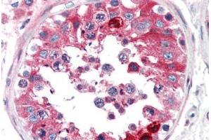 Human Testis (formalin-fixed, paraffin-embedded) stained with CLU antibody ABIN307177 at 5 ug/ml followed by biotinylated anti-mouse IgG secondary antibody ABIN481714, alkaline phosphatase-streptavidin and chromogen. (Clusterin 抗体)
