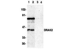 Western Blotting (WB) image for anti-serine/threonine Kinase 17b (STK17B) (C-Term) antibody (ABIN1030368) (DRAK2 抗体  (C-Term))