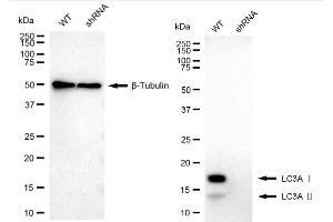 Western blotting analysis using MAP1LC3A antibody (ABIN7799409). (Recombinant MAP1LC3A 抗体)