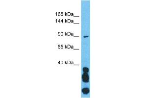 Host:  Rabbit  Target Name:  OGT  Sample Type:  721_B Whole Cell lysates  Antibody Dilution:  1. (OGT 抗体  (N-Term))