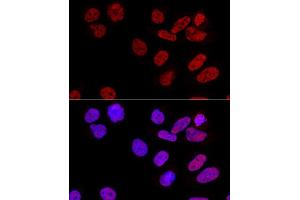 Immunofluorescence (IF) image for anti-Cleavage and Polyadenylation Specific Factor 6, 68kDa (CPSF6) antibody (ABIN6138974)
