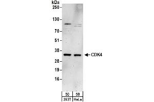 Western Blotting (WB) image for anti-Cyclin-Dependent Kinase 4 (CDK4) (AA 1-50) antibody (ABIN7453058)
