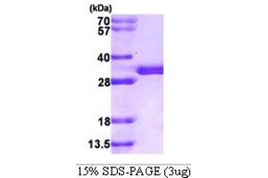 SDS-PAGE (SDS) image for Sepiapterin Reductase (SPR) (AA 1-261) protein (His tag) (ABIN666753)