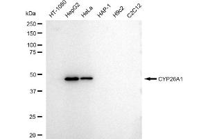 Western blotting analysis using CYP26A1 antibody (ABIN7798257).
