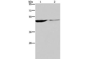 Western Blot analysis of Human paraneoplastic and normal kidney tissue using KCNK9 Polyclonal Antibody at dilution of 1:650 (KCNK9 抗体)