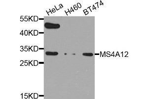 Western blot analysis of extract of various cells, using MS4A12 antibody. (MS4A12 抗体)