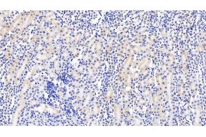 Detection of DTYMK in Mouse Kidney Tissue using Monoclonal Antibody to Deoxythymidylate Kinase (DTYMK) (DTYMK 抗体  (AA 43-190))