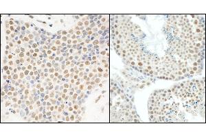 Immunohistochemistry (IHC) image for anti-Heterogeneous Nuclear Ribonucleoprotein U-Like 1 (HNRNPUL1) (AA 50-100) antibody (ABIN7453845)