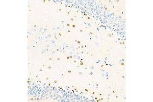 Immunohistochemistry of paraffin embedded mouse brain using SOX1 (ABIN7075712) at dilution of 1:2000 (300x lens) (SOX1 抗体)