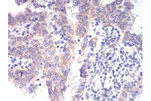 Immunohistochemistry (IHC) image for anti-Aldehyde Dehydrogenase 6 Family, Member A1 (ALDH6A1) (AA 1-195) antibody (ABIN5542265)