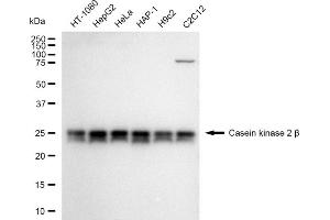 Western blotting analysis using Casein kinase 2 beta antibody (ABIN7797883). (Recombinant CSNK2B 抗体)