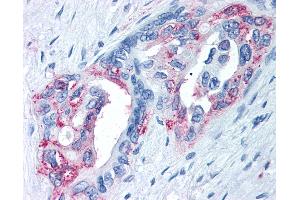 Immunohistochemistry (IHC) image for anti-Transient Receptor Potential Cation Channel, Subfamily M, Member 8 (TRPM8) (Internal Region) antibody (ABIN1049436)