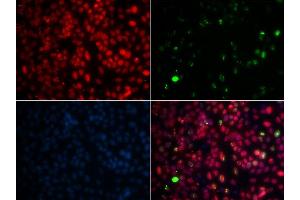 Immunofluorescence analysis of GFP-RNF168 transgenic U2OS cells using MPG antibody. (MPG 抗体  (AA 1-293))