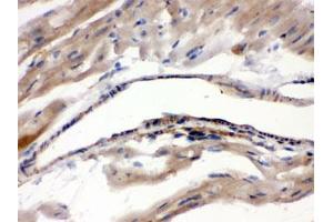 IHC testing of FFPE mouse heart with MAOA antibody. (Monoamine Oxidase A 抗体)
