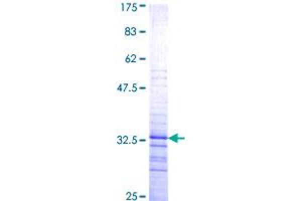 PITX2 Protein (AA 82-170) (GST tag)