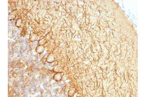 Immunohistochemistry (IHC) image for anti-Neurofilament, Light Polypeptide (NEFL) antibody (ABIN6940187)