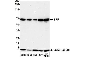 Western Blotting (WB) image for anti-Serum Response Factor (SRF) (AA 25-75) antibody (ABIN7795719)