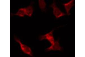 ABIN6267441 staining NIH-3T3 by IF/ICC. (RPS6KB1 抗体  (pSer424))