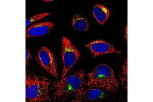 Image no. 1 for anti-Insulin-Like Growth Factor Binding Protein 7 (IGFBP7) antibody (ABIN181541) (IGFBP7 抗体)