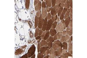 Immunohistochemical staining of human skeletal muscle with PFKM polyclonal antibody  shows strong cytoplasmic positivity in myocytes at 1:20-1:50 dilution. (PFKM 抗体)