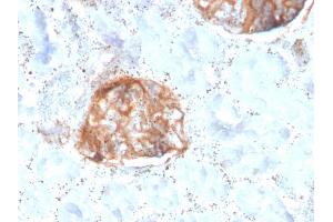 Formalin-fixed, paraffin-embedded human Kidney stained with MTAP Recombinant Mouse Monoclonal Antibody (rMTAP/1813). (Recombinant MTAP 抗体  (AA 97-196))