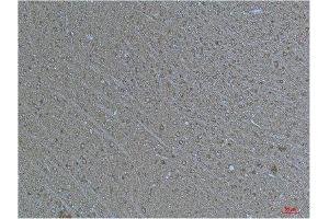 Immunohistochemistry (IHC) analysis of paraffin-embedded Human Brain Tissue using a-tubulin(Acetyl Lys40) Mouse Monoclonal Antibody diluted at 1:200. (alpha Tubulin 抗体  (acLys40))