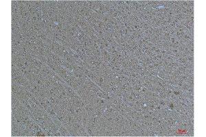 Immunohistochemistry (IHC) analysis of paraffin-embedded Human Brain Tissue using a-tubulin(Acetyl Lys40) Mouse Monoclonal Antibody diluted at 1:200. (alpha Tubulin 抗体  (acLys40))