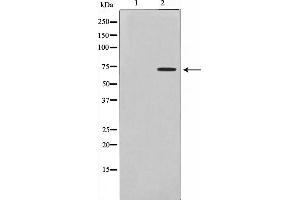 Western blot analysis on Jurkat cell lysate using DMPK Antibody,The lane on the left is treated with the antigen-specific peptide. (DMPK 抗体  (N-Term))