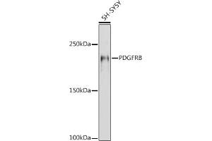 Western blot analysis of extracts of SH-SY5Y cells, using PDGFRB antibody (ABIN6134579, ABIN6145372 and ABIN7101437) at 1:1000 dilution. (PDGFRB 抗体)