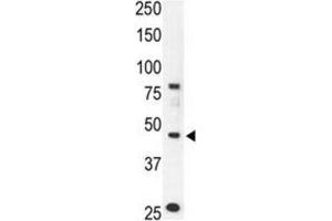 Western Blotting (WB) image for anti-Chemokine Binding Protein 2 (CCBP2) antibody (ABIN3001323) (CCBP2 抗体)