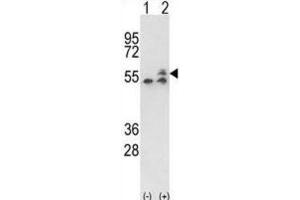 Western Blotting (WB) image for anti-ATP Synthase, H+ Transporting, Mitochondrial F1 Complex, beta Polypeptide (ATP5B) antibody (ABIN3001742) (ATP5B 抗体)