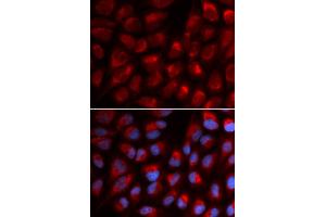 Immunofluorescence (IF) image for anti-Erythrocyte Membrane Protein Band 4.1 (Elliptocytosis 1, RH-Linked) (EPB41) antibody (ABIN1872554) (EPB41 抗体)