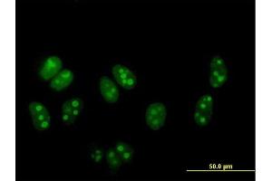 Immunofluorescence of purified MaxPab antibody to DDX54 on HeLa cell. (DDX54 抗体  (AA 1-881))