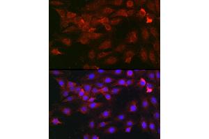 Immunofluorescence analysis of C6 cells using Heparanase 1 Rabbit pAb (ABIN6128033, ABIN6141977, ABIN6141978 and ABIN6221391) at dilution of 1:100 (40x lens). (HPSE 抗体  (AA 36-275))