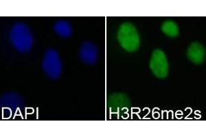 Immunofluorescence analysis of 293T cell using H3R26me2s antibody. (Histone 3 抗体  (H3R26me2s))