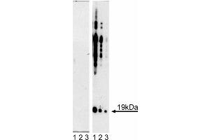 Western blot analysis of alpha-Synuclein (pY125). (SNCA 抗体  (pTyr125, Tyr125))