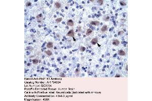 Human Brain (RNF141 抗体  (Middle Region))