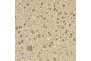 Immunohistochemistry of paraffin-embedded mouse brain using DNMT3A antibody at dilution of 1:200 (x400 lens) (DNMT3A 抗体)