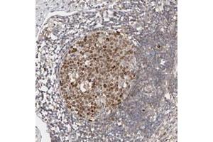 Immunohistochemical staining of human appendix with CDCA7L polyclonal antibody  shows strong nuclear positivity in lymphoid reaction center cells at 1:500-1:1000 dilution. (CDCA7L 抗体)