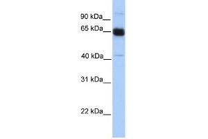 WB Suggested Anti-PRKAA1 Antibody Titration: 0. (PRKAA1 抗体  (N-Term))