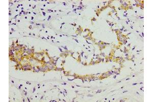 Immunohistochemistry (IHC) image for anti-Collagen, Type XI, alpha 1 (COL11A1) (AA 532-699) antibody (ABIN7148223)