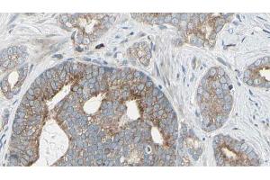ABIN6268974 at 1/100 staining Human prostate tissue by IHC-P. (EIF4B 抗体  (pSer422))
