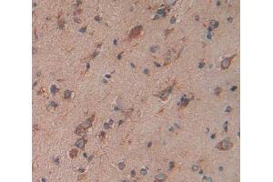 Used in DAB staining on fromalin fixed paraffin- embedded Kidney tissue (SLC44A1 抗体  (AA 74-183))