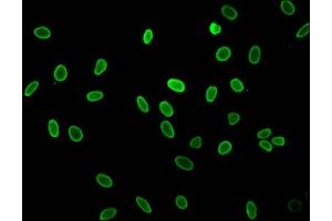 Immunofluorescent analysis of Hela cells (sodium butyrate, 30 mM, 4h) using ABIN7139162 at dilution of 1:100 and Alexa Fluor 488-congugated AffiniPure Goat Anti-Rabbit IgG(H+L) (HIST1H1C 抗体  (acLys16))