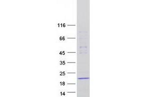 DNAL1 Protein (Myc-DYKDDDDK Tag)