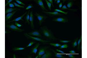 Immunofluorescence of purified MaxPab antibody to SPINT2 on HeLa cell. (SPINT2 抗体  (AA 1-252))