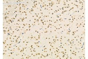 ABIN6265493 and ABIN6279878 at 1/100 staining Rat brain tissue by IHC-P. (TCEAL2 抗体  (Internal Region))
