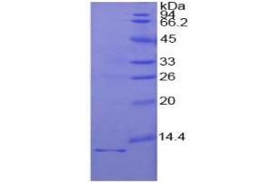 SDS-PAGE of Protein Standard from the Kit  (Highly purified E. (IL1R1 ELISA 试剂盒)