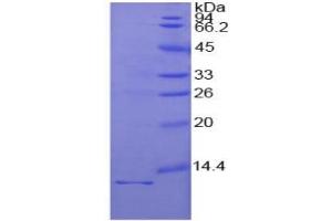 SDS-PAGE (SDS) image for Interleukin 1 Receptor, Type I (IL1R1) ELISA Kit (ABIN6730877)